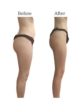 リカバリー(&recovery)/中半身のモタつきrecovery