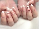 ホワイトフレンチ×さくらんぼ