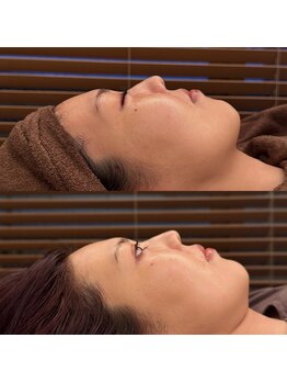 こうぞう整体院/美容鍼×ララピール