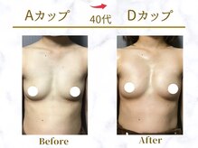 Ms.やまとなでしこ/ビフォーアフター