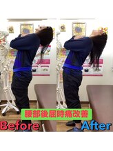 ヒデ整体院(Hide整体院)/猫背矯正骨盤矯正B/A肩こり腰痛