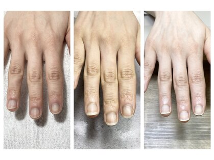 ドルフィネイルの写真