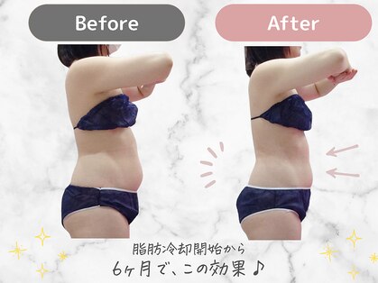 ミネット(minette)の写真