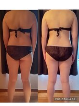 ルナ(Luna)/全身痩身before after