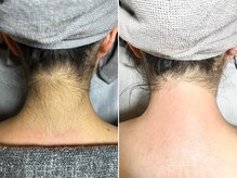 エヴァワックス 恵比寿店(Eva Wax)/【オススメ】ブライダルの準備に