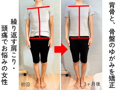 リノ(Lino)の写真