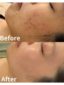 スリリアン 銀座/★お客さまビフォーアフター★