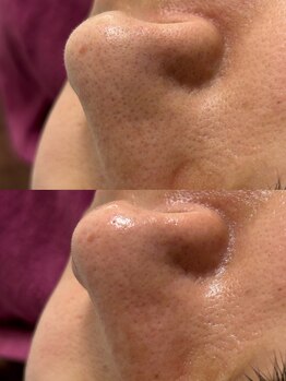 サロン エム(saron M)/お客様ビフォーアフター