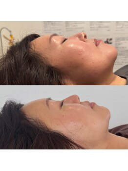 こうぞう整体院/美容鍼×ララピール