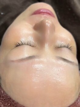 ホウレイ線・たるみ改善！予防ケア