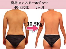 ファニービー 高槻店/症例写真