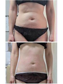 リラ(LiLas)の写真/【リアボーテ×パワーレメディ】最強タッグでお体の悩みを根本改善★癒し＆結果に感動のボディメイク♪