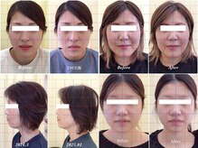 いじり整体院の雰囲気（小顔/フェイスライン/ほうれい線/Before・After）