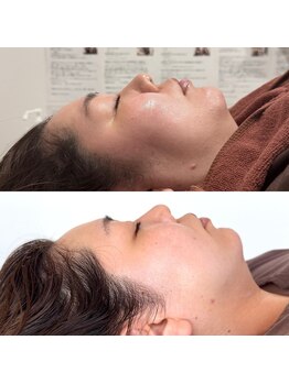 こうぞう整体院/美容鍼×ララピール