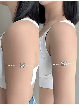 ワミ 八潮(WAMI)/二の腕・ハミ肉ケアをしたい