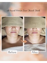 シャルール(Chaleur)/before after