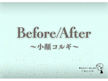 千歳の女神 刈谷店/Before/After