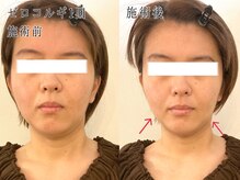 サロン カピリナ(salon Kapilina)