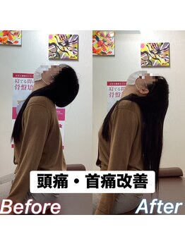 ヒデ整体院(Hide整体院)/猫背矯正骨盤矯正B/A肩こり腰痛