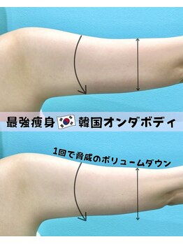カンナムビューティー 町田/マイクロリフト/町田/ララピール