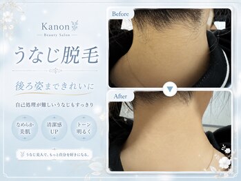 カノン 南熊本店(Kanon)/