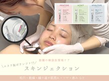 リアン(Rien)の雰囲気（毛穴・ニキビを土台となる内側から整える韓国肌管理ケア）