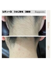 ラポール(rappore;)/レディースうなじ脱毛