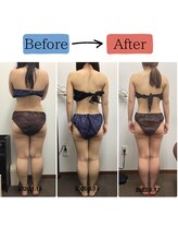 ステイゴールド美容整体院(STAY GOLD)/下半身スッキリ