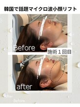 ウナ デ リンゴル 恵比寿店(UNA de Ringol)/