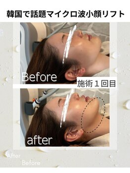 ウナ デ リンゴル 恵比寿店(UNA de Ringol)/