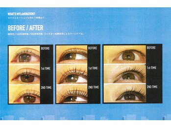 ツインズ/マイラミネーション