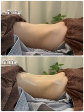 ヨジャラボ(ヨジャLAB)/チネイザン　ビフォーアフター