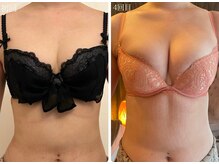 美人バスト 岡崎店/【バストアップ★育乳】症例