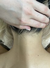 ナノハナ/鹿沼市の全身脱毛のナノハナ