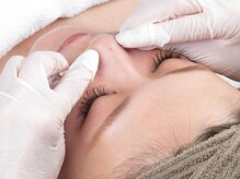 プシュケ(Psyche)/黒ずみに毛穴エクストラクション