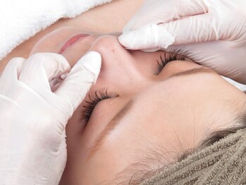 プシュケ(Psyche)/黒ずみに毛穴エクストラクション