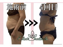 エリクシア 松戸/50代痩身くびれ集中