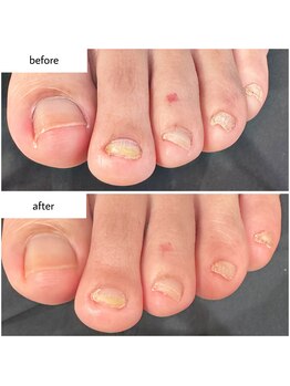 ケアプラス(care plus)/フットネイルケア