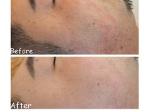 アイティス(Salon Its)/【Before &After】