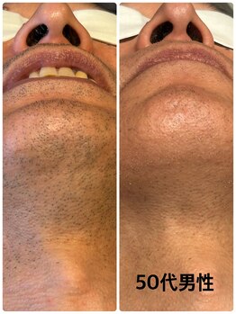 シェルビー(SHELBY)/50代男性