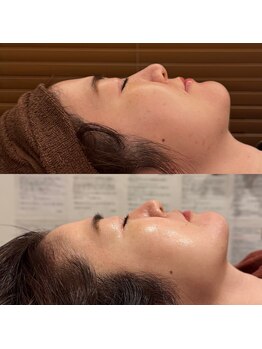 こうぞう整体院/美容鍼×ララピール