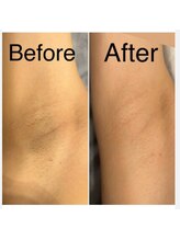 リノ ポノ(Lino Pono)/ピンクローマ色味改善