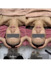 ルメール(Lemaile)/小顔/小顔効果