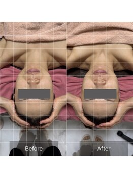 ルメール(Lemaile)/小顔/小顔効果