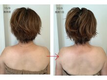 イーリス(i-ris)/美容整体×肩甲骨はがし×リンパ