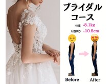 誠心堂整骨院 ネイルサロンアヴェニール(Avenir)/ブライダルコース