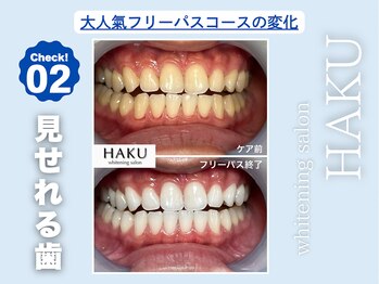 ハク 袋井磐田店(HAKU)/あ客様before→after 2