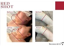 美ネージュの雰囲気（レッドショットでフェイスラインもボディラインも解決♪）