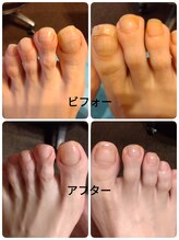 フットケアサロン ラビフット(Rabbi foot)/滑らかさを目指します