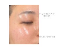 アデージョ アデオス(Ade-jyo.Adeosu)の雰囲気(【シェービング】産毛/角質/透明感up/トーンup)